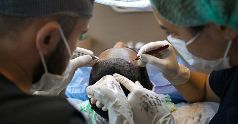 transplantation cheveux